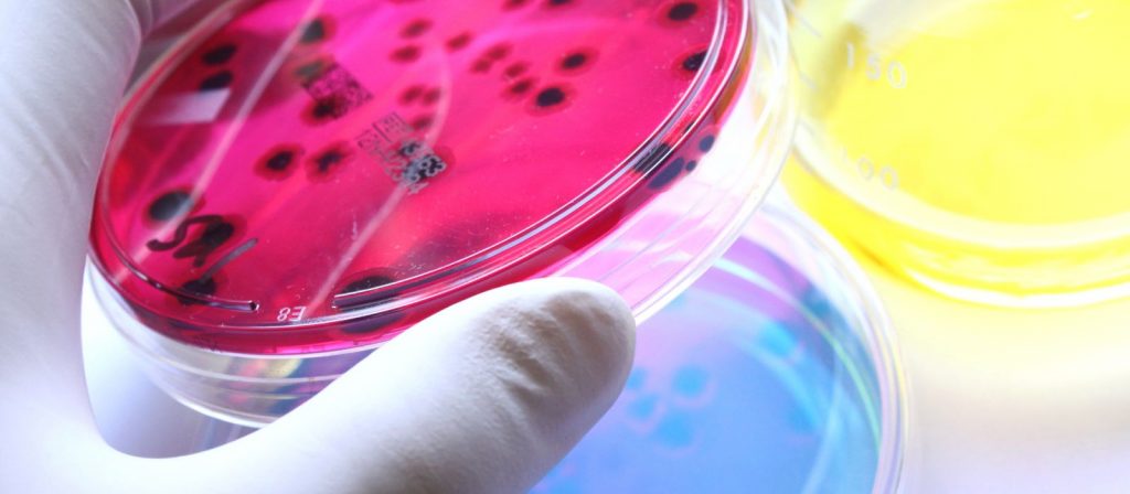 Ágar Cromogênico