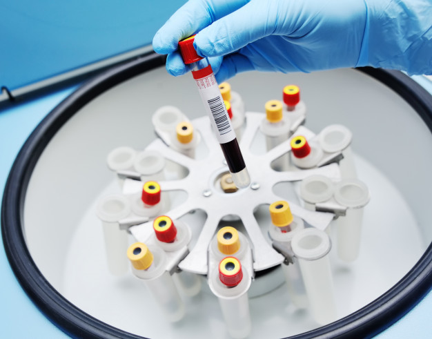 O que são centrífugas ?Equipamento de Laboratório importante.