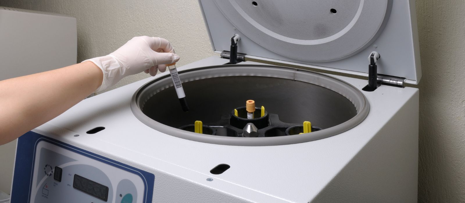 O que são centrífugas ?Equipamento de Laboratório importante.
