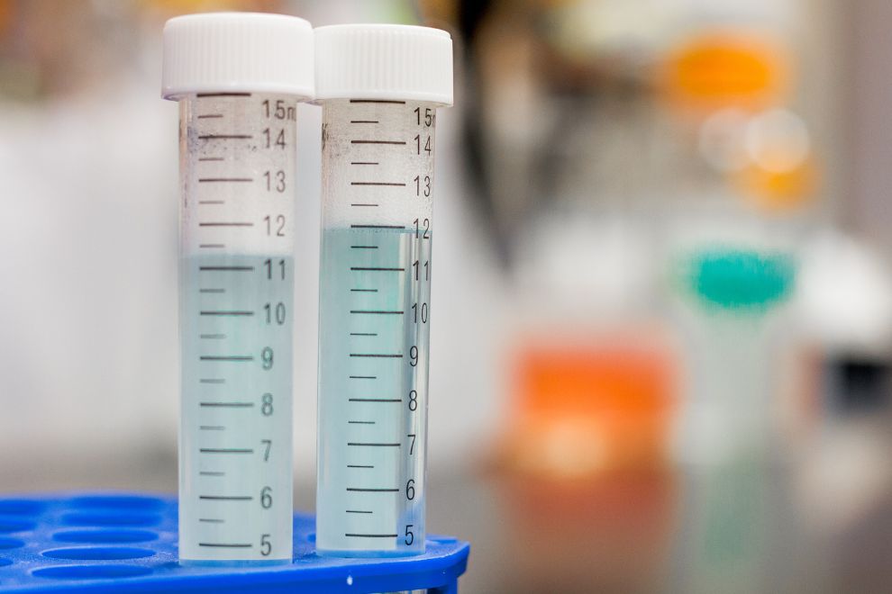 Importância do Armazenamento Correto de Insumos Laboratoriais